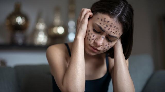 How to Clear Dark Spots on Face: Simple Tips for Clear Skin